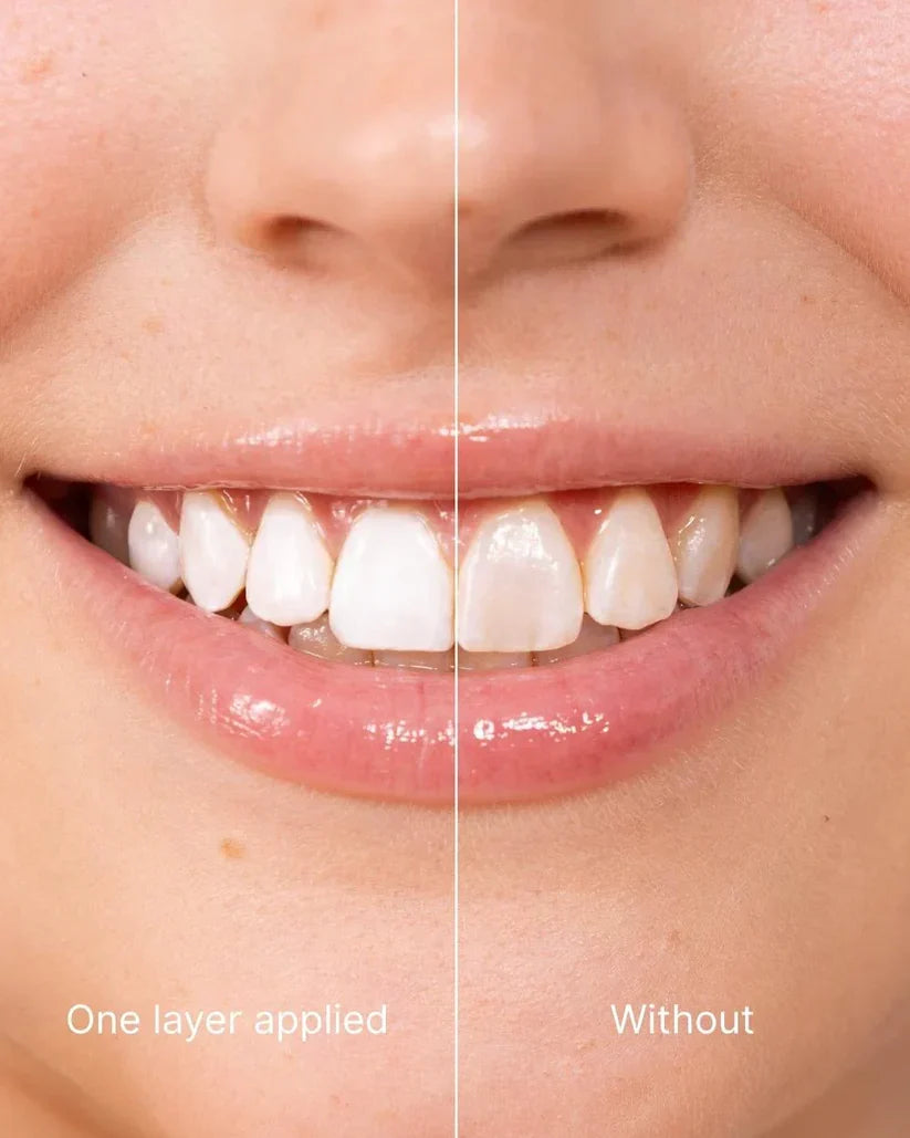 SMILEFITPRO™ Tooth Polish - Instant Clean Smile