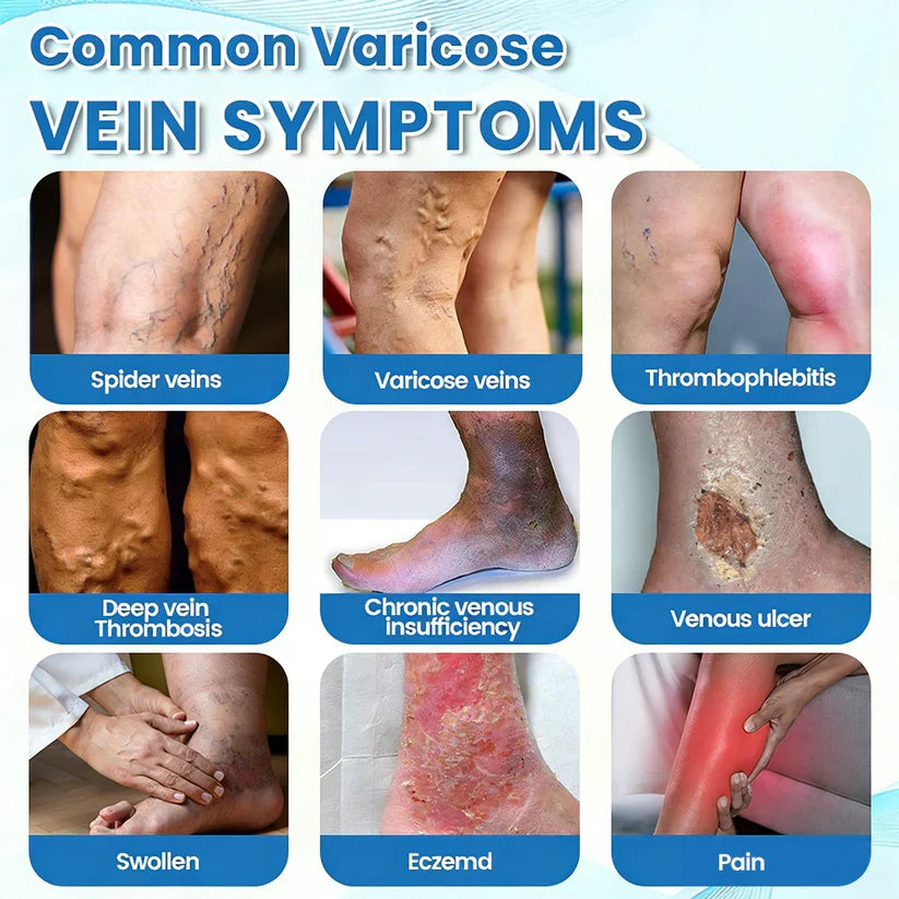 🇨🇦🏆COUGEX® VascuCare Vein Healing Spray(Designed for Varicose veins, Spider veins, Deep vein Thrombosis, Chronic venous insufficiency, Venous ulcers, Thrombophlebitis and other venous issues)