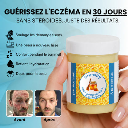 Soothe itching and provide intense daily hydration