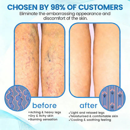 🇨🇦🏆COUGEX® VascuCare Vein Healing Spray(Designed for Varicose veins, Spider veins, Deep vein Thrombosis, Chronic venous insufficiency, Venous ulcers, Thrombophlebitis and other venous issues)