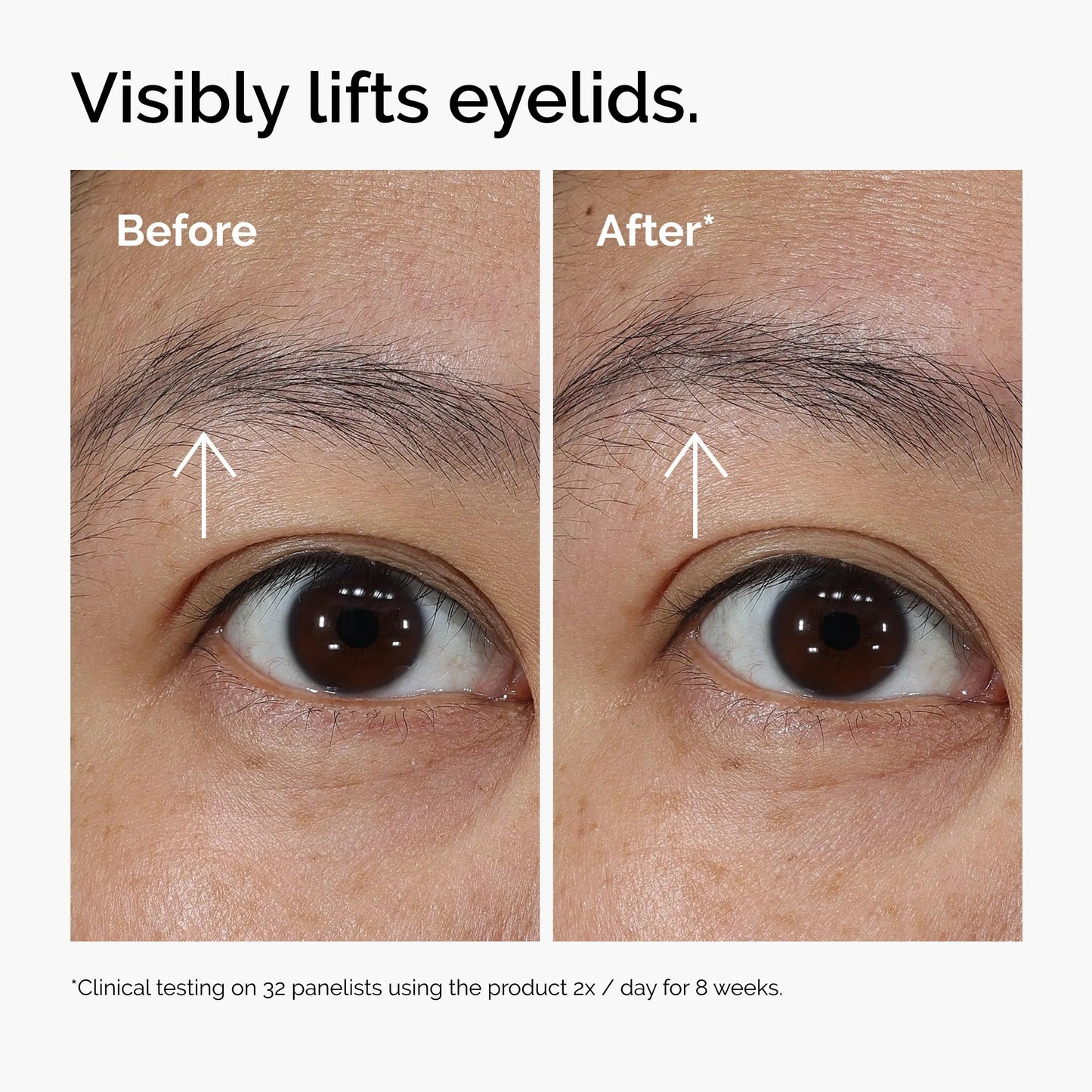 The Insideefy Lacto-PDRN* 4% + B9 Eye Cream