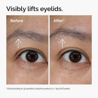 The Insideefy Lacto-PDRN* 4% + B9 Eye Cream