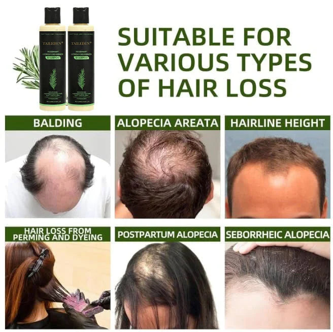 (🔥LAST DAY SALE-70% OFF)🌱 TAILEDEN® Organic Rosemary Hair Growth Shampoo