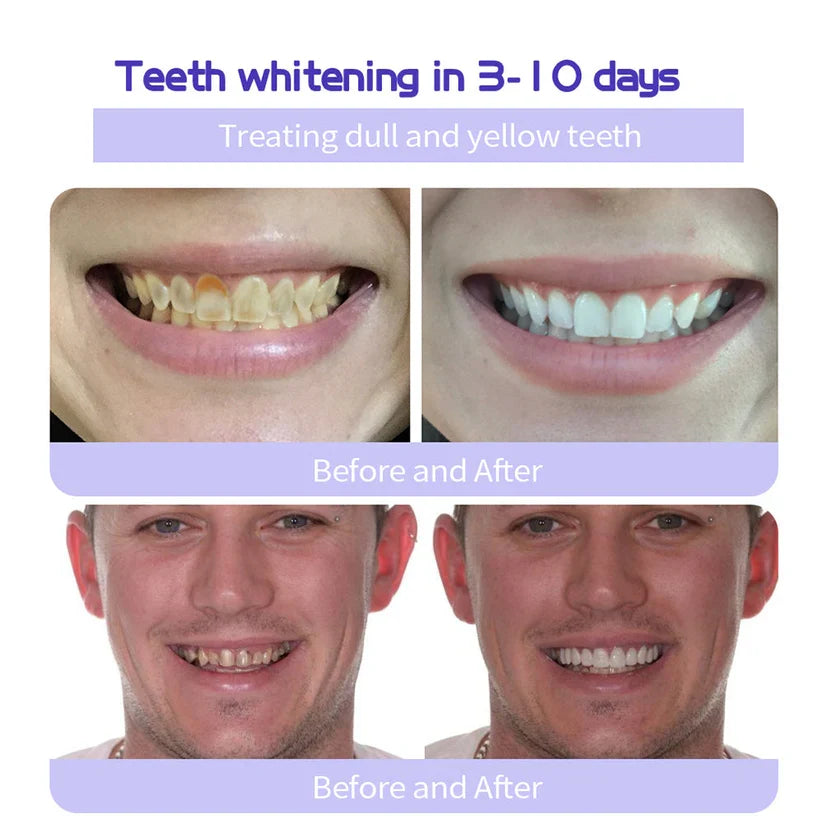 🦷 Nexisify™ Tooth Powder – Natural Whitening & Fresh Breath!