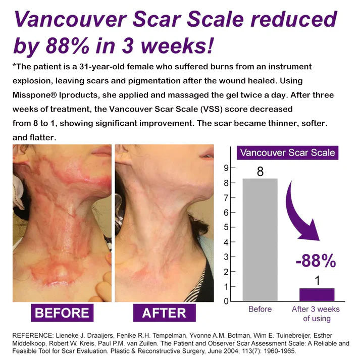 Advanced Scar Gel – Treats old and new scars, helps reduce the appearance of scars from acne, surgery, burns, injuries, and stretch marks