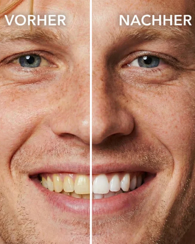 SMILEFITPRO™ Tooth Polish - Instant Clean Smile