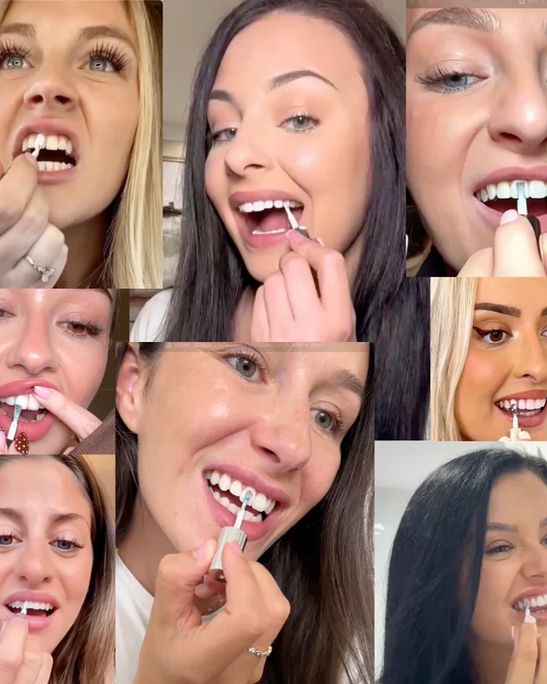 SMILEFITPRO™ Tooth Polish - Instant Clean Smile