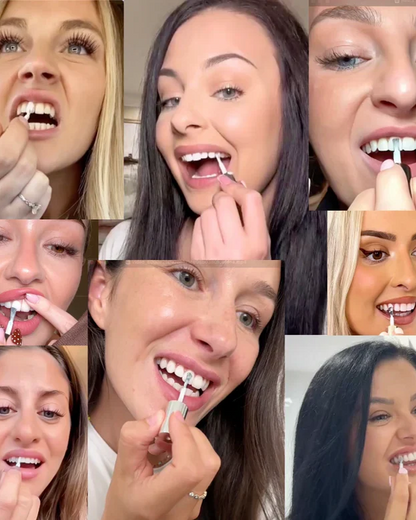 SMILEFITPRO™ Tooth Polish - Instant Clean Smile