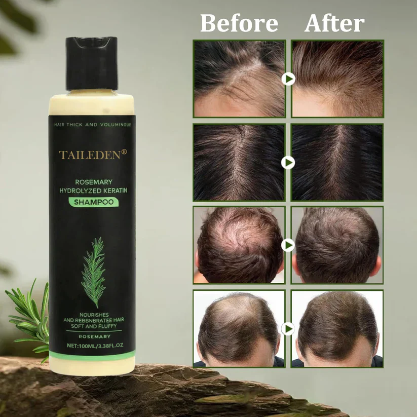 (🔥LAST DAY SALE-70% OFF)🌱 TAILEDEN® Organic Rosemary Hair Growth Shampoo