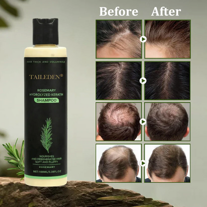 (🔥LAST DAY SALE-70% OFF)🌱 TAILEDEN® Organic Rosemary Hair Growth Shampoo