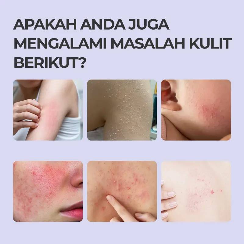 Skin-Soothing Gel, Skin-Conditioning Gel – Care for Your Skin