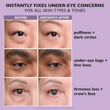 🔥 Last 3 Hours 50% OFF ✨ BUY 1 GET 1 FREE🔥Eye Bag Eraser — Instantly Refreshes, Firms & Smooths for a Youthful Look That Lasts 8 Hours