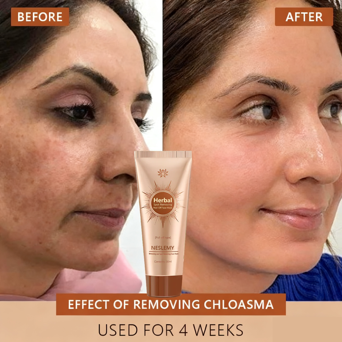 Whitening and Spot-Removing Face Mask Suitable for face and body – 👩‍⚕️ Natural ingredients permanently remove age spots, freckles, sun spots, and liver spots.