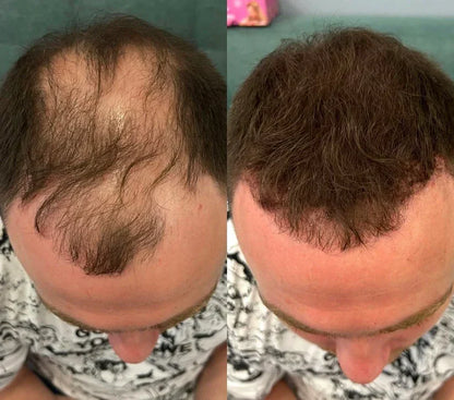 Misspone™ - Revive Your Hairline Powder