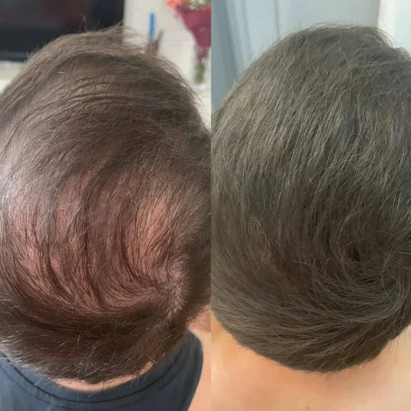 Misspone™ - Revive Your Hairline Powder