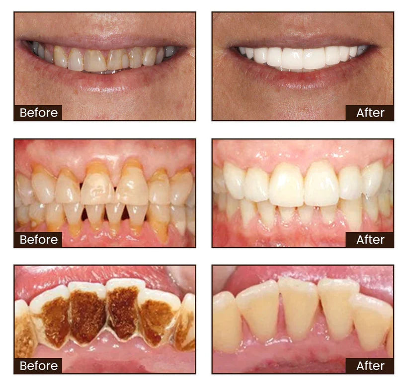 Niacinamide Whitening Toothpaste