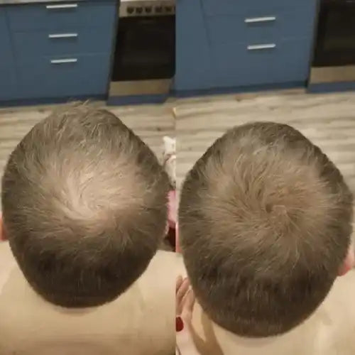 Misspone™ - Revive Your Hairline Powder