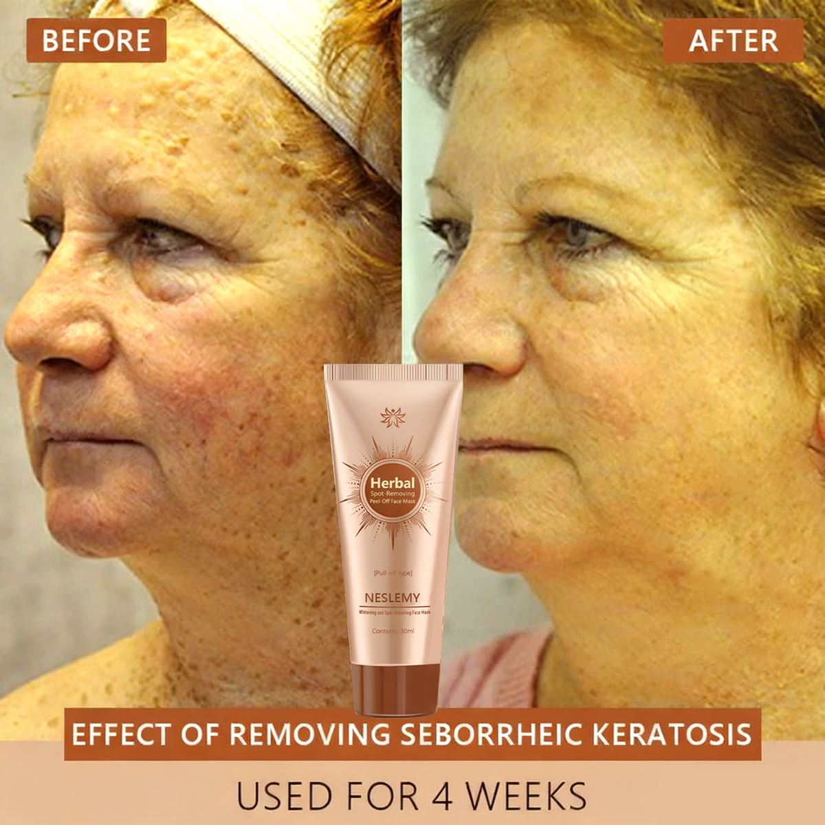 🏵️ NESLEMY™ Whitening and Spot-Removing Face Mask Suitable for face and body