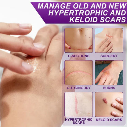 Advanced Scar Gel – Treats old and new scars, helps reduce the appearance of scars from acne, surgery, burns, injuries, and stretch marks
