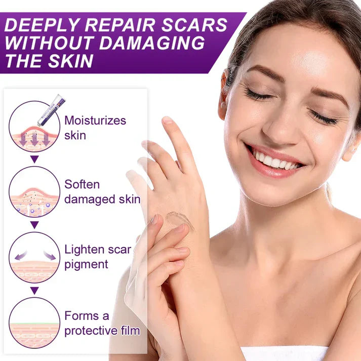 Advanced Scar Gel – Treats old and new scars, helps reduce the appearance of scars from acne, surgery, burns, injuries, and stretch marks