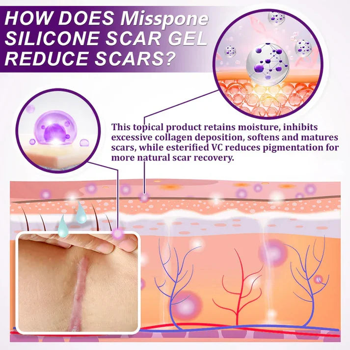 Advanced Scar Gel – Treats old and new scars, helps reduce the appearance of scars from acne, surgery, burns, injuries, and stretch marks