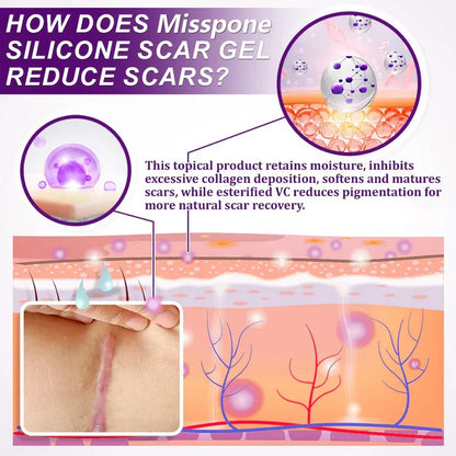 Advanced Scar Gel – Treats old and new scars, helps reduce the appearance of scars from acne, surgery, burns, injuries, and stretch marks