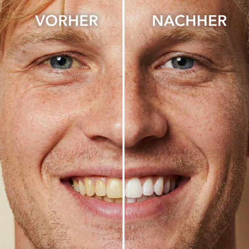 SMILEFITPRO™ Tooth Polish