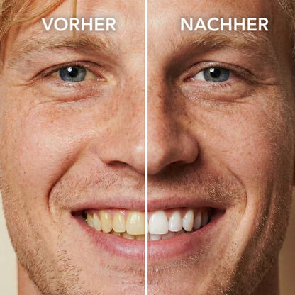 SMILEFITPRO™ Tooth Polish
