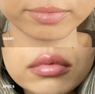 Gloss for volume and hydration