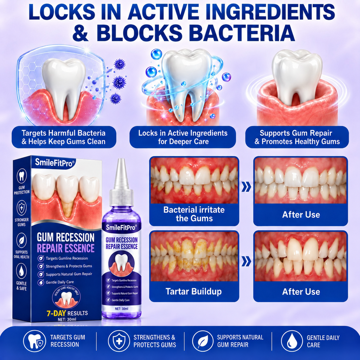 SmileFitPro®🏆Gum Recession Periodontal Care Gel-up