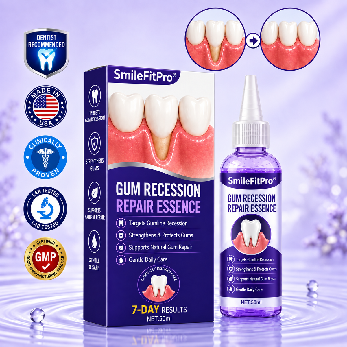 SmileFitPro®🏆Gum Recession Periodontal Care Gel-up