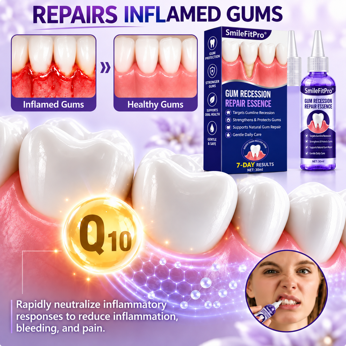 SmileFitPro®🏆Gum Recession Periodontal Care Gel-up