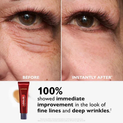 🔥 Last 3 Hours 50% OFF ✨ BUY 1 GET 1 FREE🔥Eye Bag Eraser — Instantly Refreshes, Firms & Smooths for a Youthful Look That Lasts 8 Hours