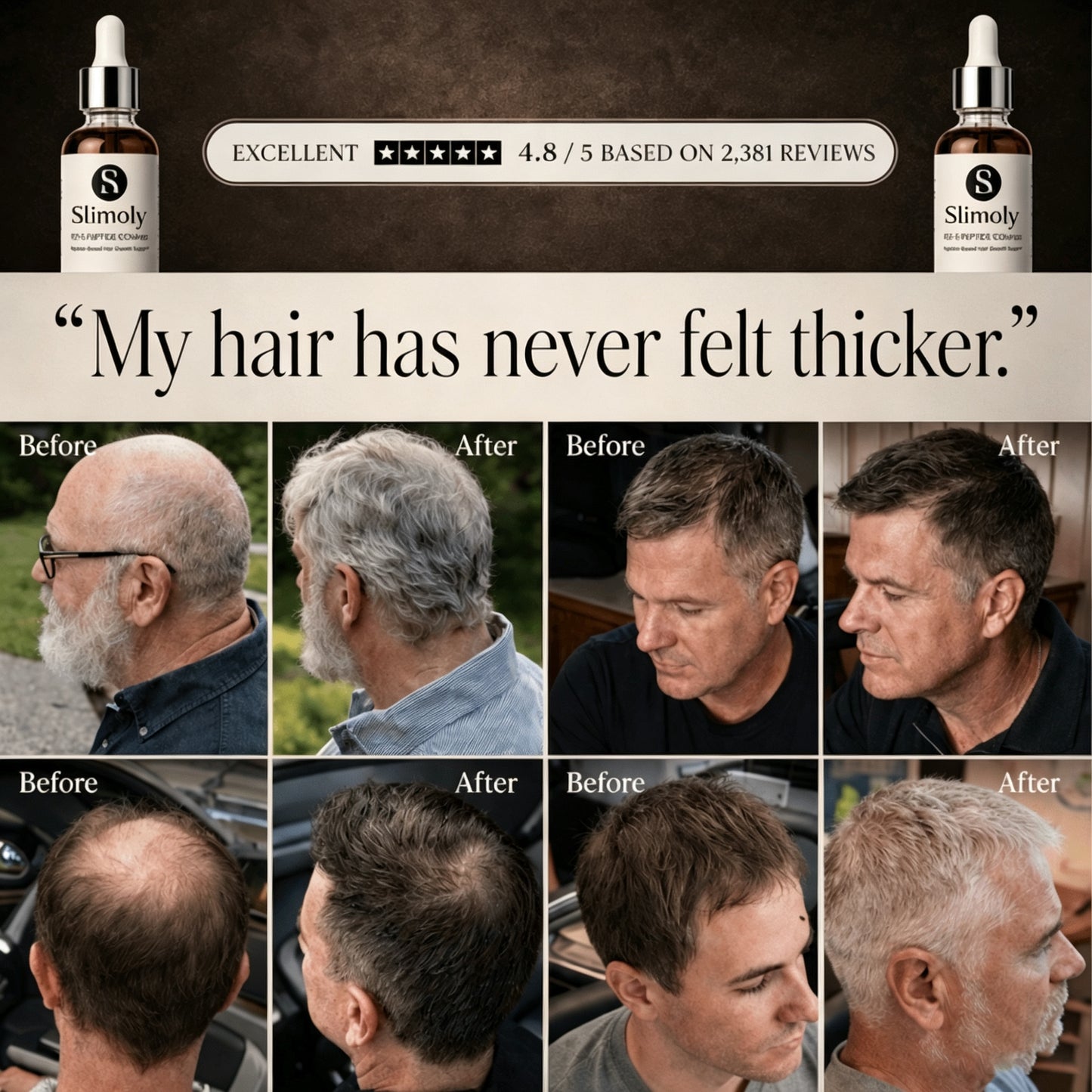 Revolutionary FST-5 Peptide Hair Growth Complex By Slimoly™