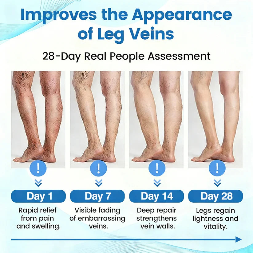 🇨🇦🏆COUGEX® VascuCare Vein Healing Spray(Designed for Varicose veins, Spider veins, Deep vein Thrombosis, Chronic venous insufficiency, Venous ulcers, Thrombophlebitis and other venous issues)