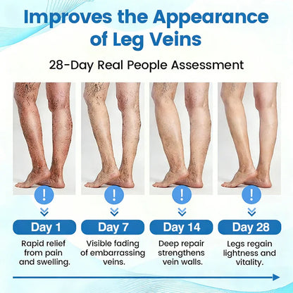 🇨🇦🏆COUGEX® VascuCare Vein Healing Spray(Designed for Varicose veins, Spider veins, Deep vein Thrombosis, Chronic venous insufficiency, Venous ulcers, Thrombophlebitis and other venous issues)