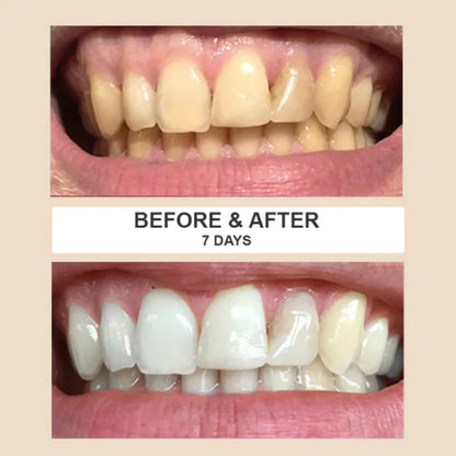 Medazy™ Natural Herbal Teeth Cleaning Stick