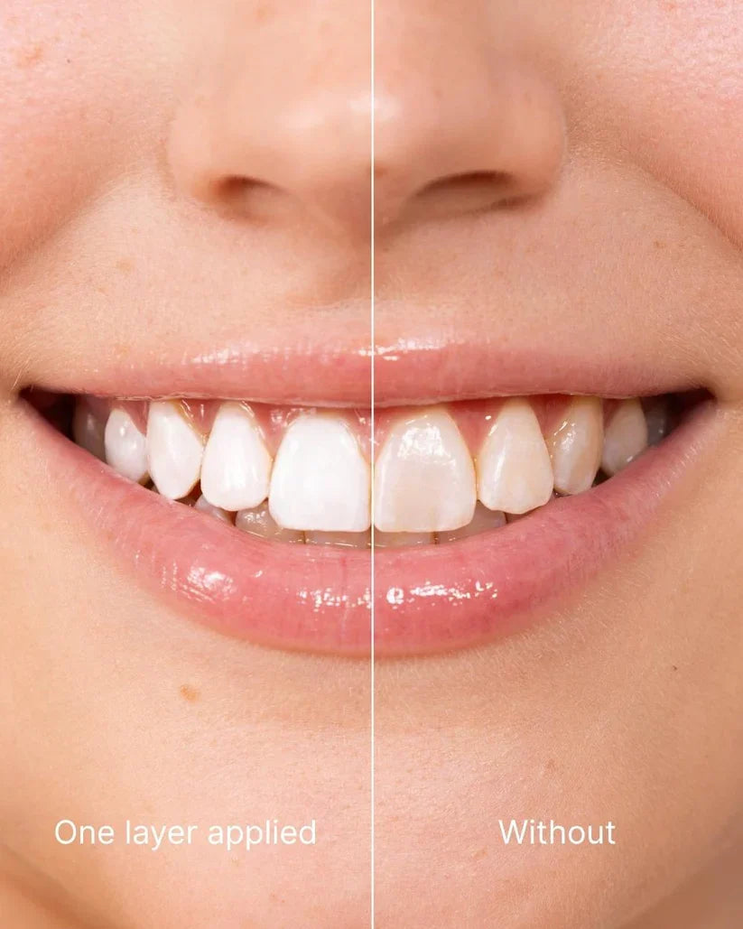 Teeth Polish- Official Authentic | Instant Clean Smile