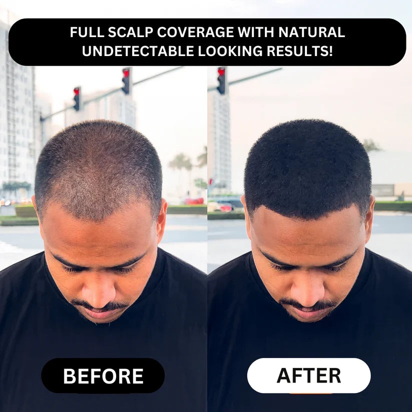 Misspone™ - Revive Your Hairline Powder