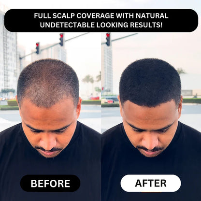 Misspone™ - Revive Your Hairline Powder
