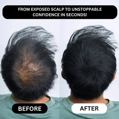 Misspone™ - Revive Your Hairline Powder