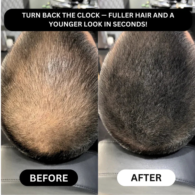 Misspone™ - Revive Your Hairline Powder