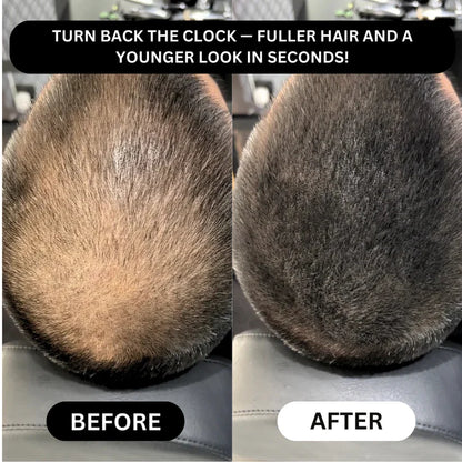 Misspone™ - Revive Your Hairline Powder
