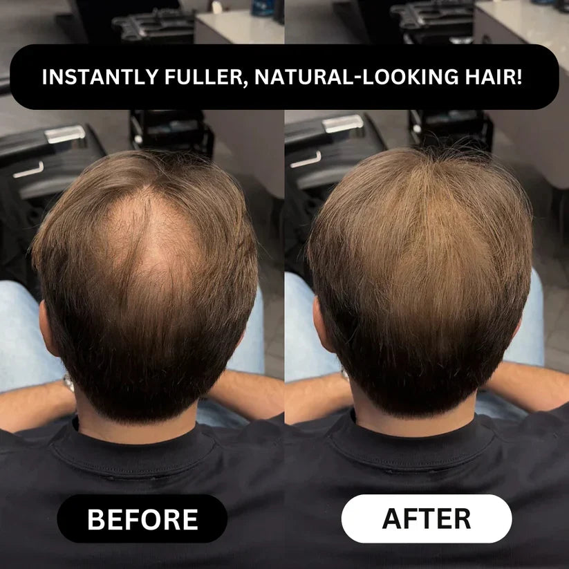 Misspone™ - Revive Your Hairline Powder