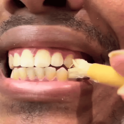 Medazy™ Natural Herbal Teeth Cleaning Stick